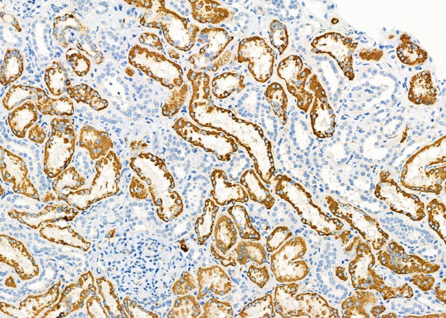 SLC5A6 Antibody in Immunohistochemistry (Paraffin) (IHC (P))