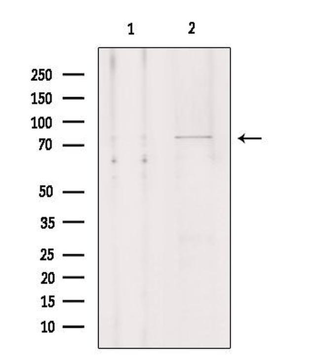 OATP1 Antibody in Western Blot (WB)