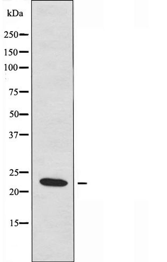 STMN4 Antibody in Western Blot (WB)