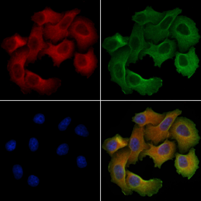 TCP-1 epsilon Antibody in Immunocytochemistry (ICC/IF)