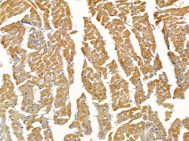 TCP-1 epsilon Antibody in Immunohistochemistry (Paraffin) (IHC (P))