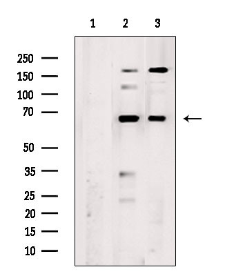 TCP-1 epsilon Antibody in Western Blot (WB)