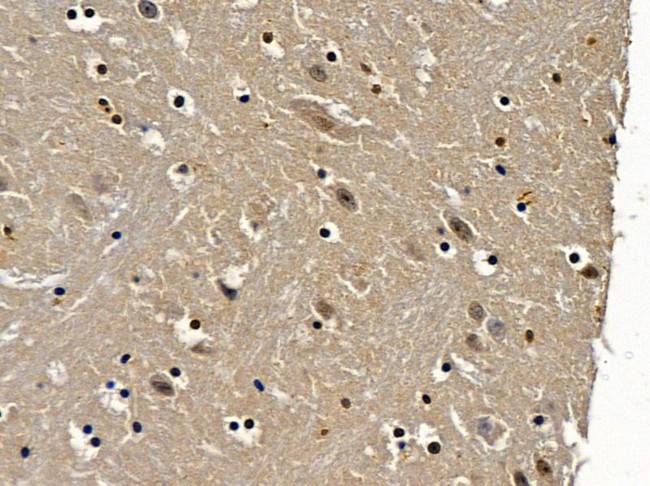 TAF3 Antibody in Immunohistochemistry (Paraffin) (IHC (P))