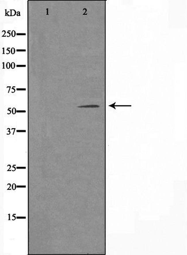 TSEN54 Antibody in Western Blot (WB)