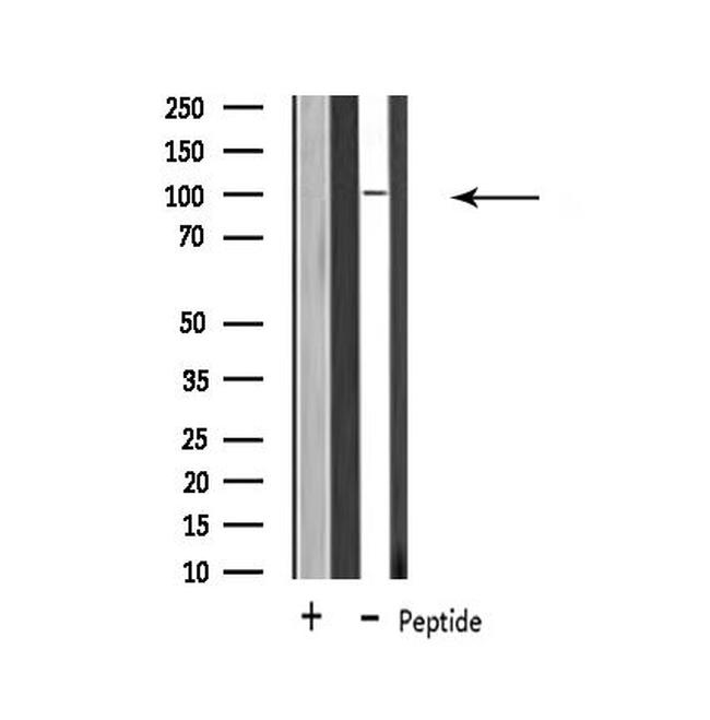 USP11 Antibody in Western Blot (WB)