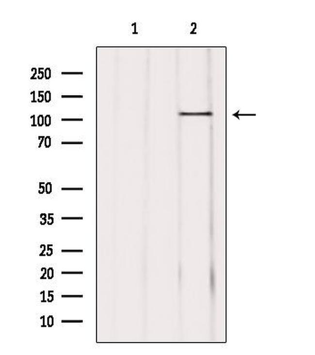 USP11 Antibody in Western Blot (WB)