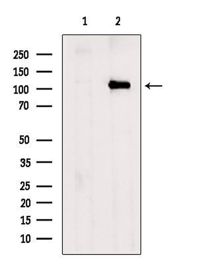 USP15 Antibody in Western Blot (WB)