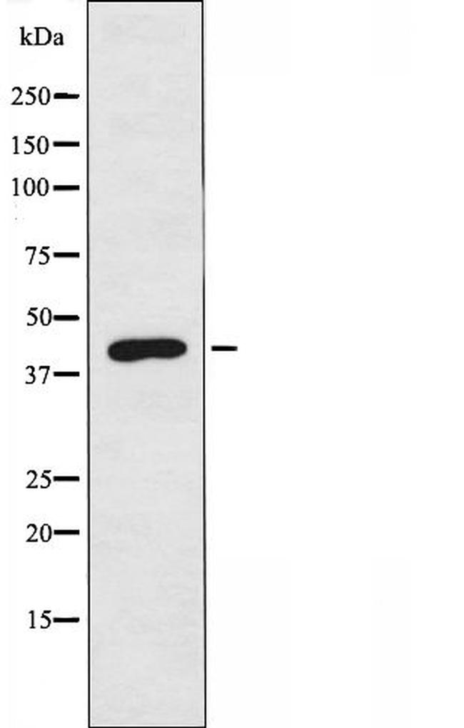 UBAC1 Antibody in Western Blot (WB)