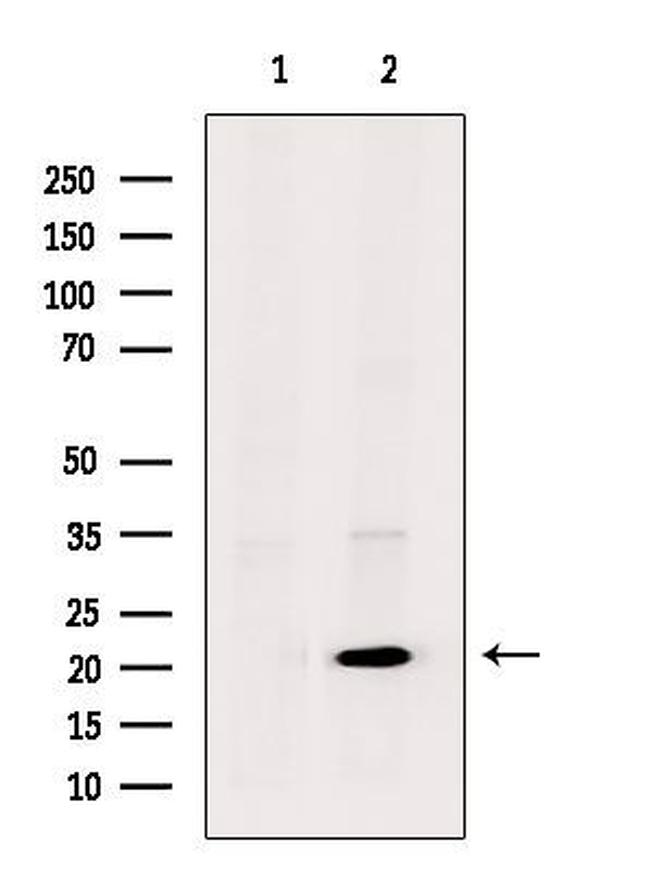 UBE2T Antibody in Western Blot (WB)