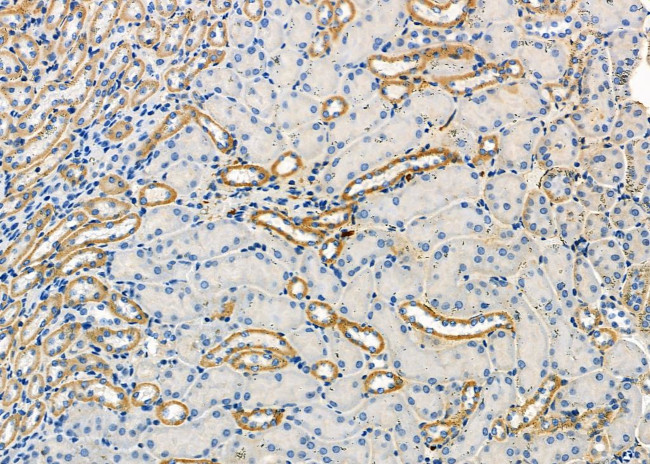 ATP6V1C2 Antibody in Immunohistochemistry (Paraffin) (IHC (P))