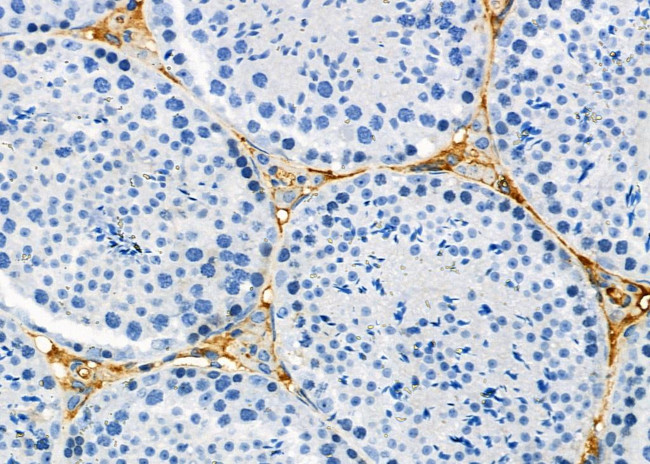 ATP6V1C2 Antibody in Immunohistochemistry (Paraffin) (IHC (P))