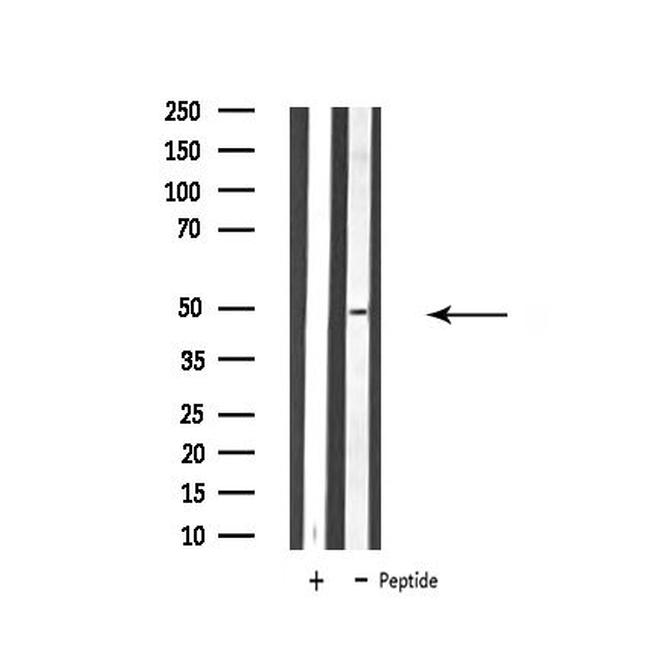 ATP6V1C2 Antibody in Western Blot (WB)