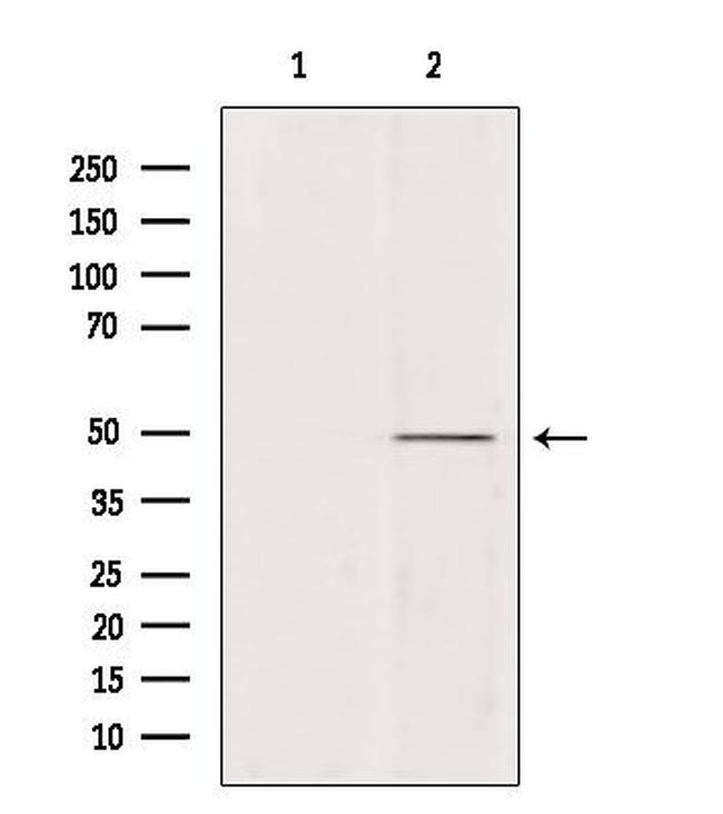 ATP6V1C2 Antibody in Western Blot (WB)