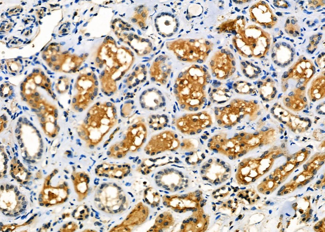 WAVE2 Antibody in Immunohistochemistry (Paraffin) (IHC (P))