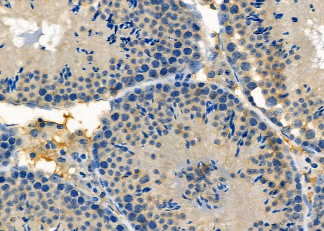 WAVE2 Antibody in Immunohistochemistry (Paraffin) (IHC (P))