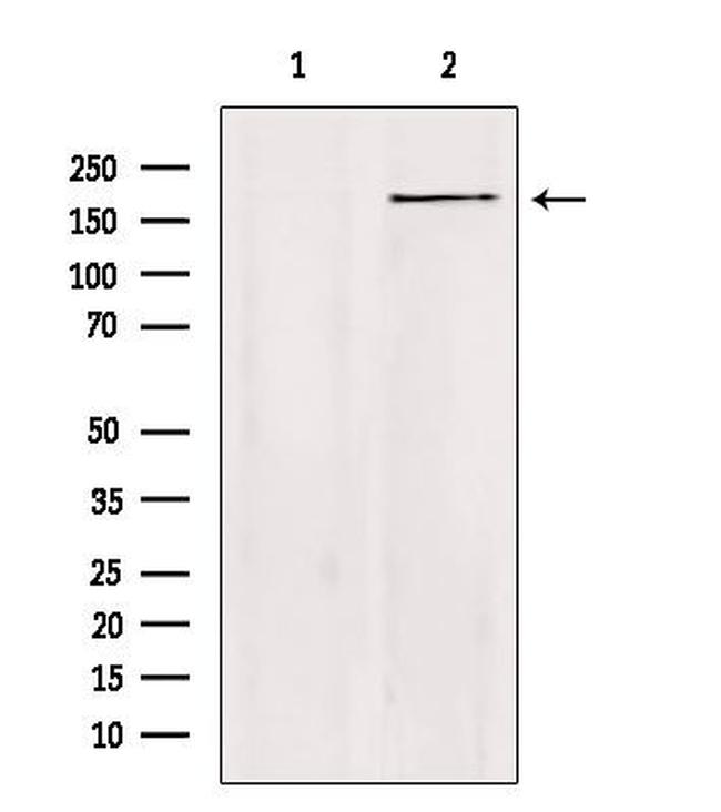 ZC3H13 Antibody in Western Blot (WB)