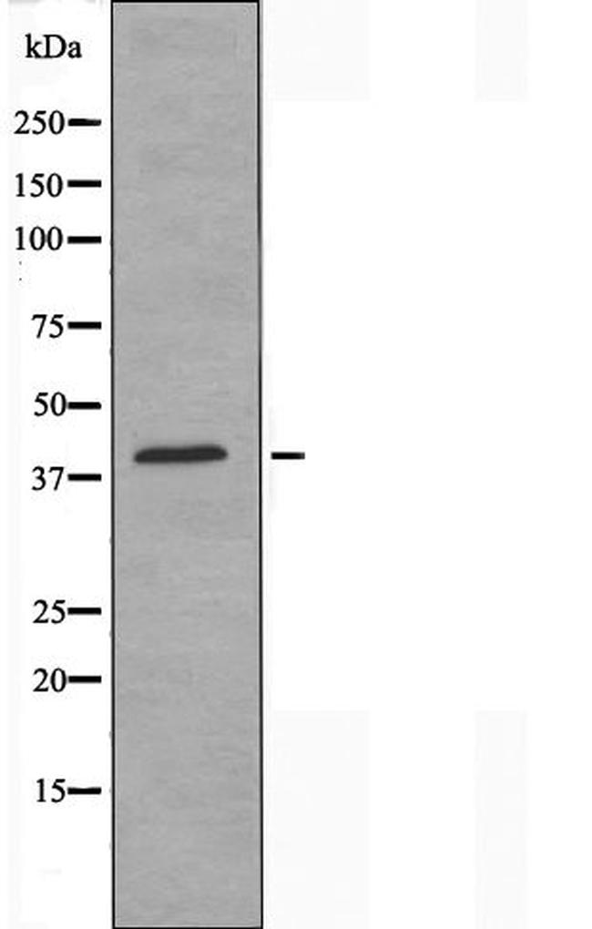 ZC3H8 Antibody in Western Blot (WB)