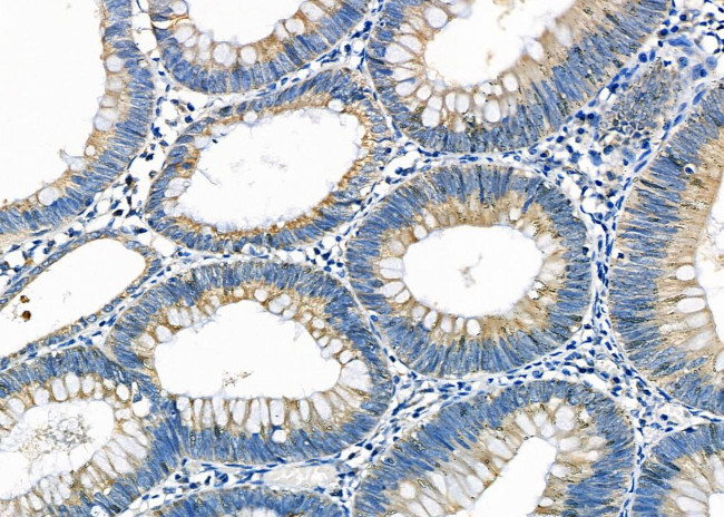 ZFYVE19 Antibody in Immunohistochemistry (Paraffin) (IHC (P))