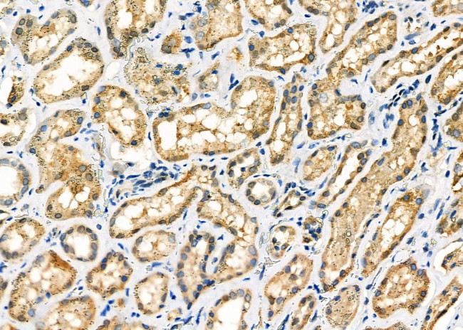 ZFYVE19 Antibody in Immunohistochemistry (Paraffin) (IHC (P))