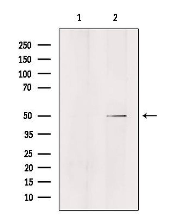 ZFYVE19 Antibody in Western Blot (WB)