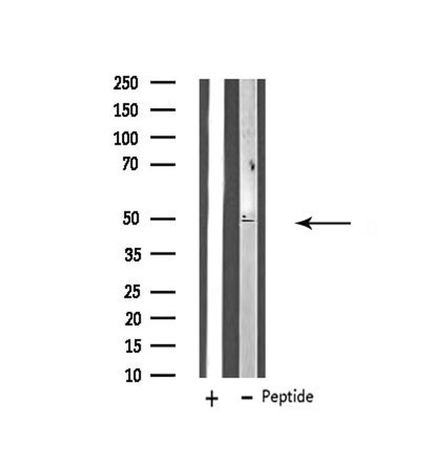 ZFYVE19 Antibody in Western Blot (WB)