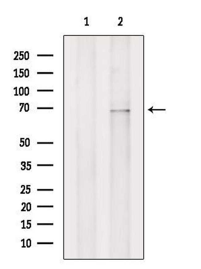 ZIP4 Antibody in Western Blot (WB)