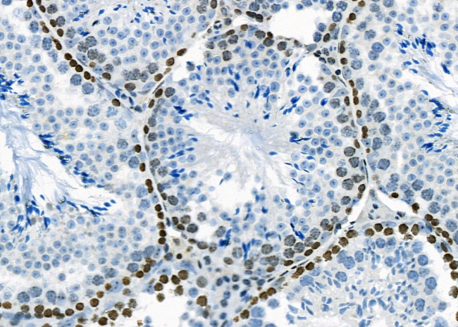 PTGR2 Antibody in Immunohistochemistry (Paraffin) (IHC (P))