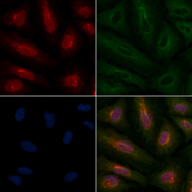 RAD51C Antibody in Immunocytochemistry (ICC/IF)