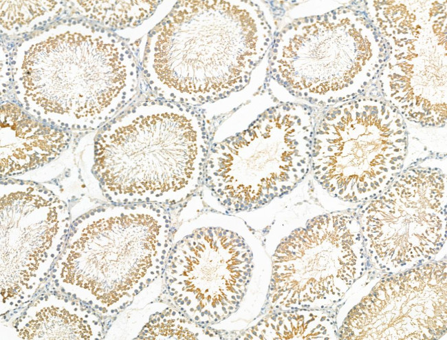 RAD51C Antibody in Immunohistochemistry (Paraffin) (IHC (P))