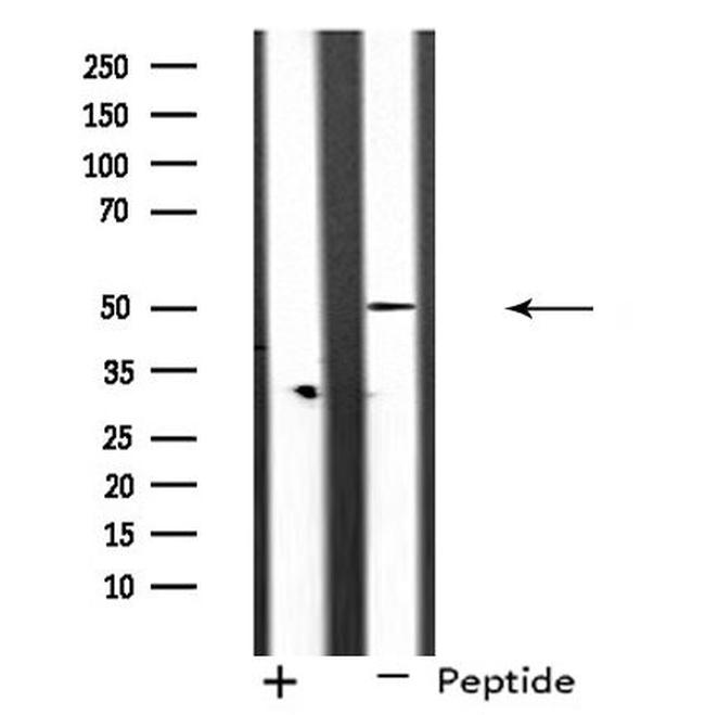 RAD51C Antibody in Western Blot (WB)