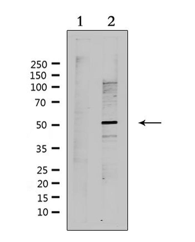 RAD51C Antibody in Western Blot (WB)