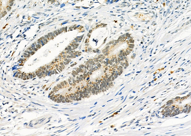 RALY Antibody in Immunohistochemistry (Paraffin) (IHC (P))