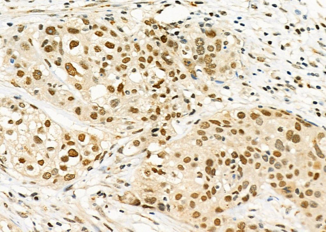 RALY Antibody in Immunohistochemistry (Paraffin) (IHC (P))