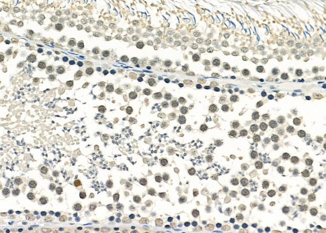 RALY Antibody in Immunohistochemistry (Paraffin) (IHC (P))