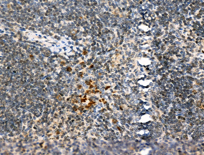 TBPL2 Antibody in Immunohistochemistry (Paraffin) (IHC (P))