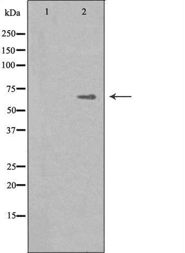 IKZF4 Antibody in Western Blot (WB)