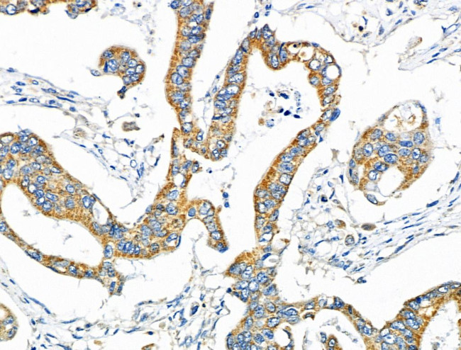 NDFIP1 Antibody in Immunohistochemistry (Paraffin) (IHC (P))