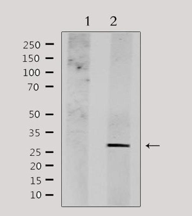 NDFIP1 Antibody in Western Blot (WB)