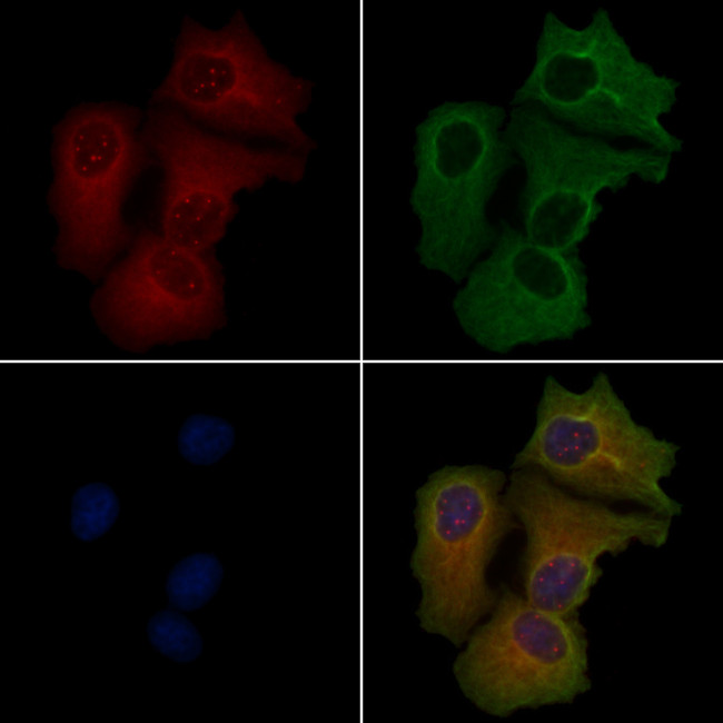 IL15RA Antibody in Immunocytochemistry (ICC/IF)