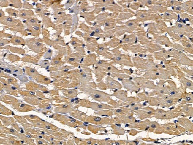 IL15RA Antibody in Immunohistochemistry (Paraffin) (IHC (P))