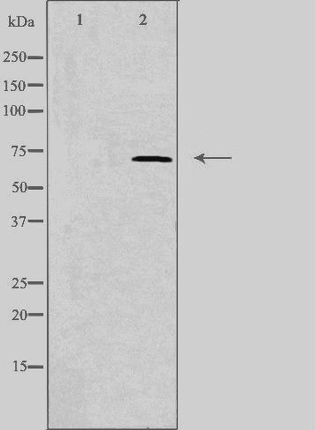 IL17RC Isoform 1 Precursor Antibody in Western Blot (WB)