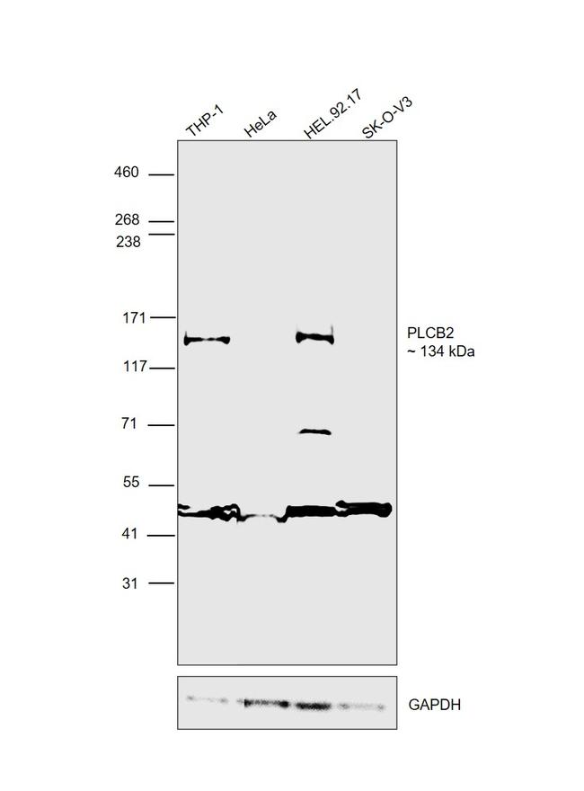 PLCB2 Antibody in Western Blot (WB)