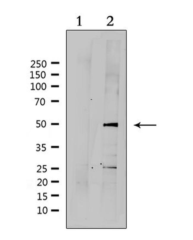 SUV39H2 Antibody in Western Blot (WB)