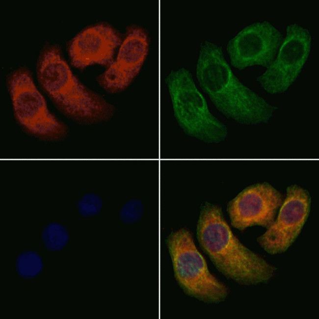 CYP4A11/CYP4A22 Antibody in Immunocytochemistry (ICC/IF)