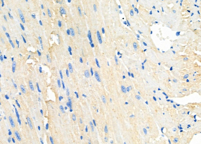 PIK3CG Antibody in Immunohistochemistry (Paraffin) (IHC (P))