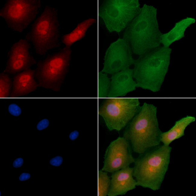 MAGEC2 Antibody in Immunocytochemistry (ICC/IF)