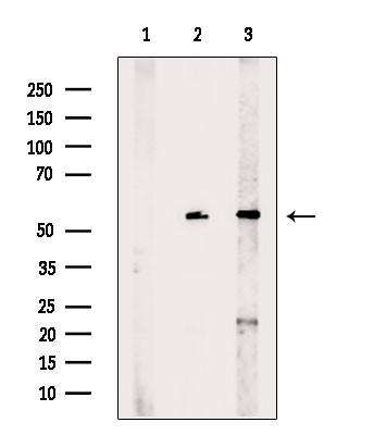 MAGEC2 Antibody in Western Blot (WB)