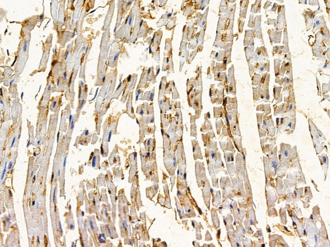 LOK Antibody in Immunohistochemistry (Paraffin) (IHC (P))