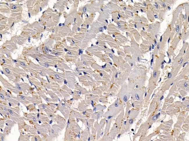 PHKG1 Antibody in Immunohistochemistry (Paraffin) (IHC (P))