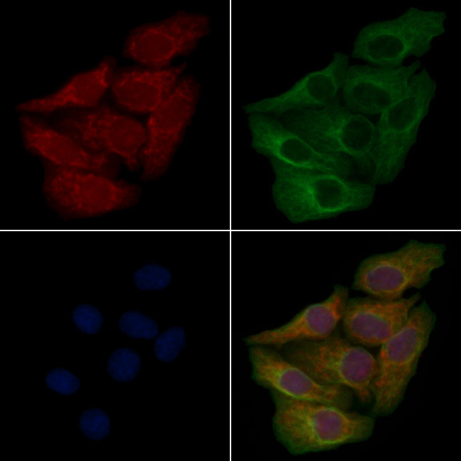 ACTBL2 Antibody in Immunocytochemistry (ICC/IF)